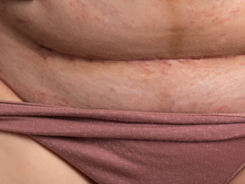 keizersnee happy healthcare