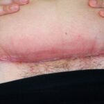 keizersnee happy healthcare